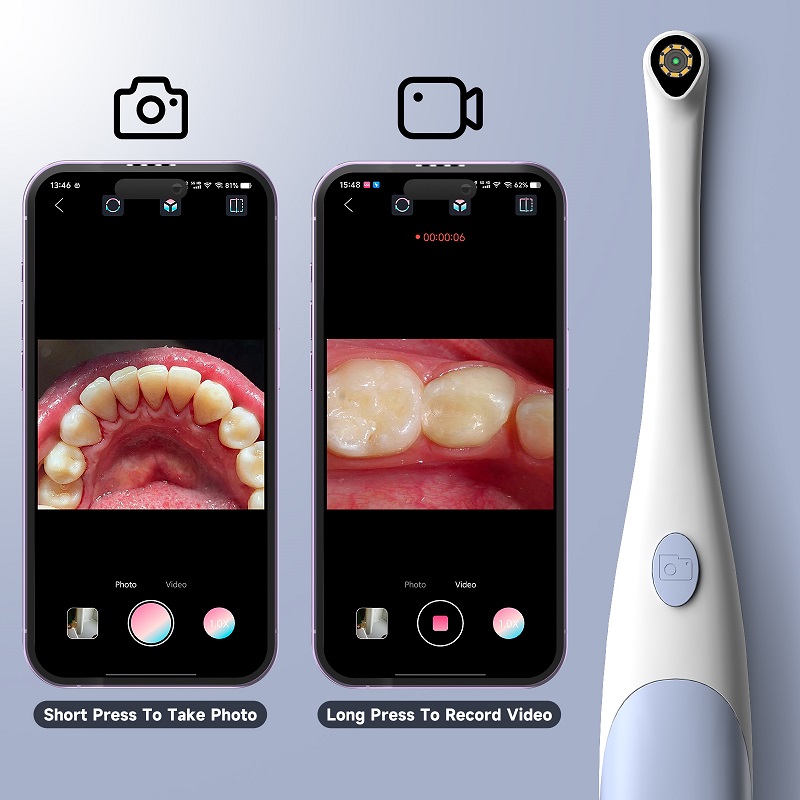 Oral Endoscope Camera 1440P Ph - огляд і ціна Photography Lighting Handheld